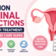 Common Vaginal Infections and Their Treatment: Causes and Care Guide