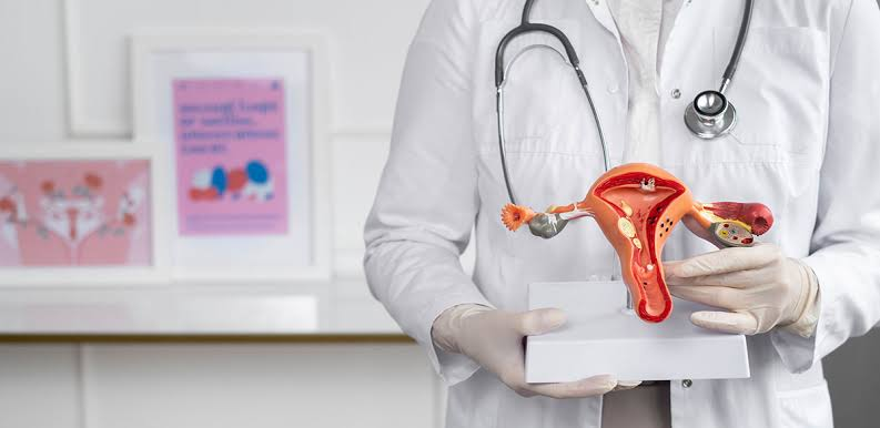 PCOS affects fertility